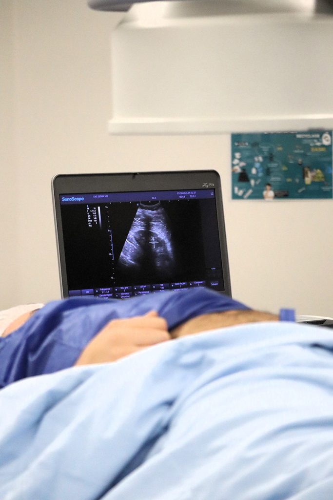 urologie matériel échographie