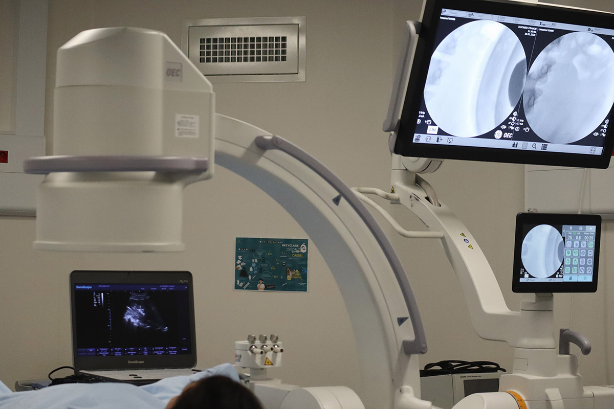 urologie matériel machine échographie